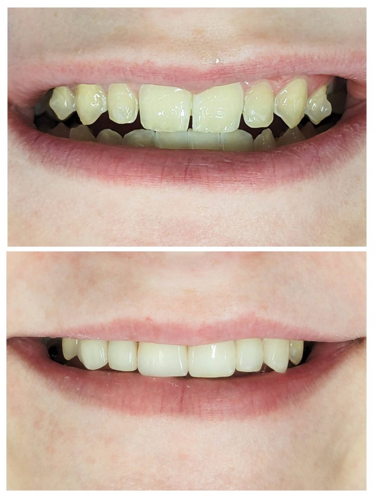 20240123_080301-COLLAGE