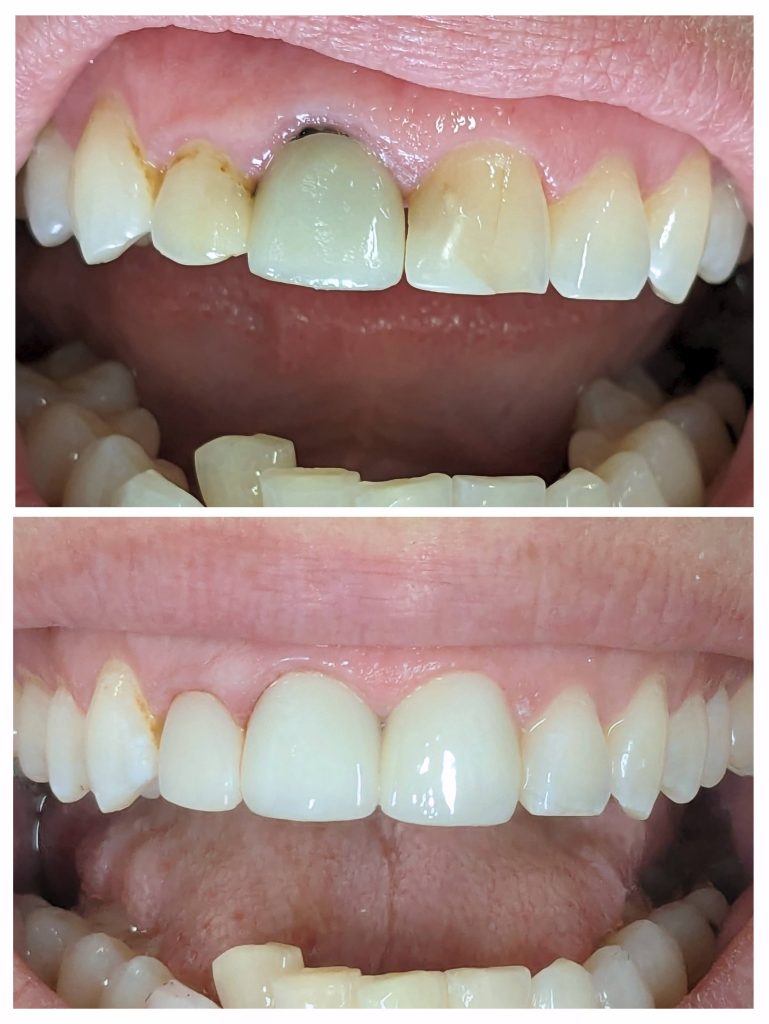 20240131_175803-COLLAGE