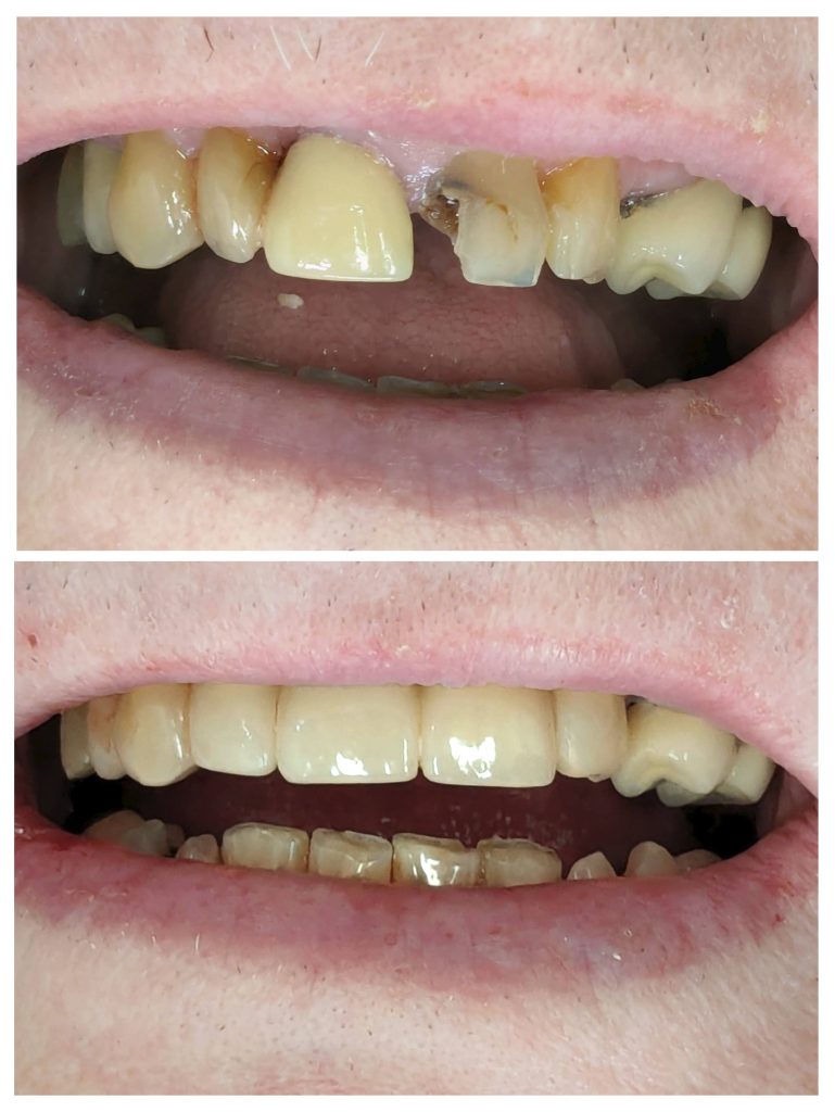 20240313_170614-COLLAGE