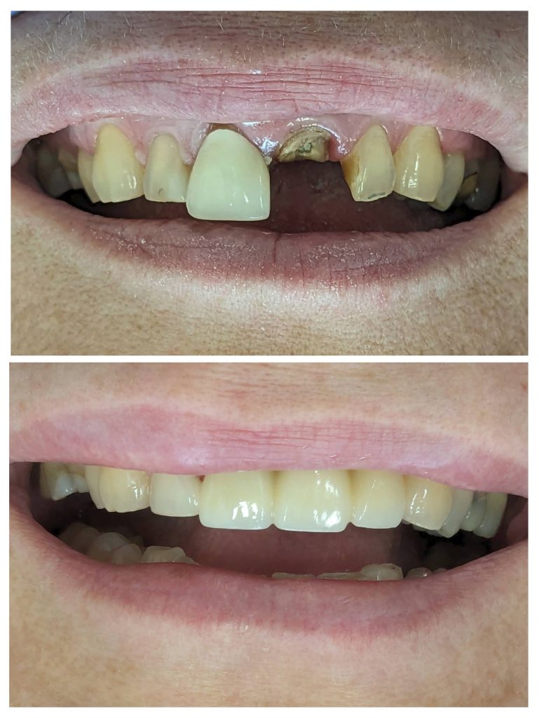 20240402_112440-COLLAGE