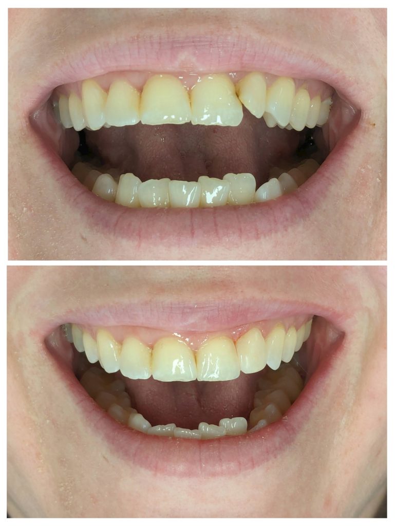 20240410_201859-COLLAGE