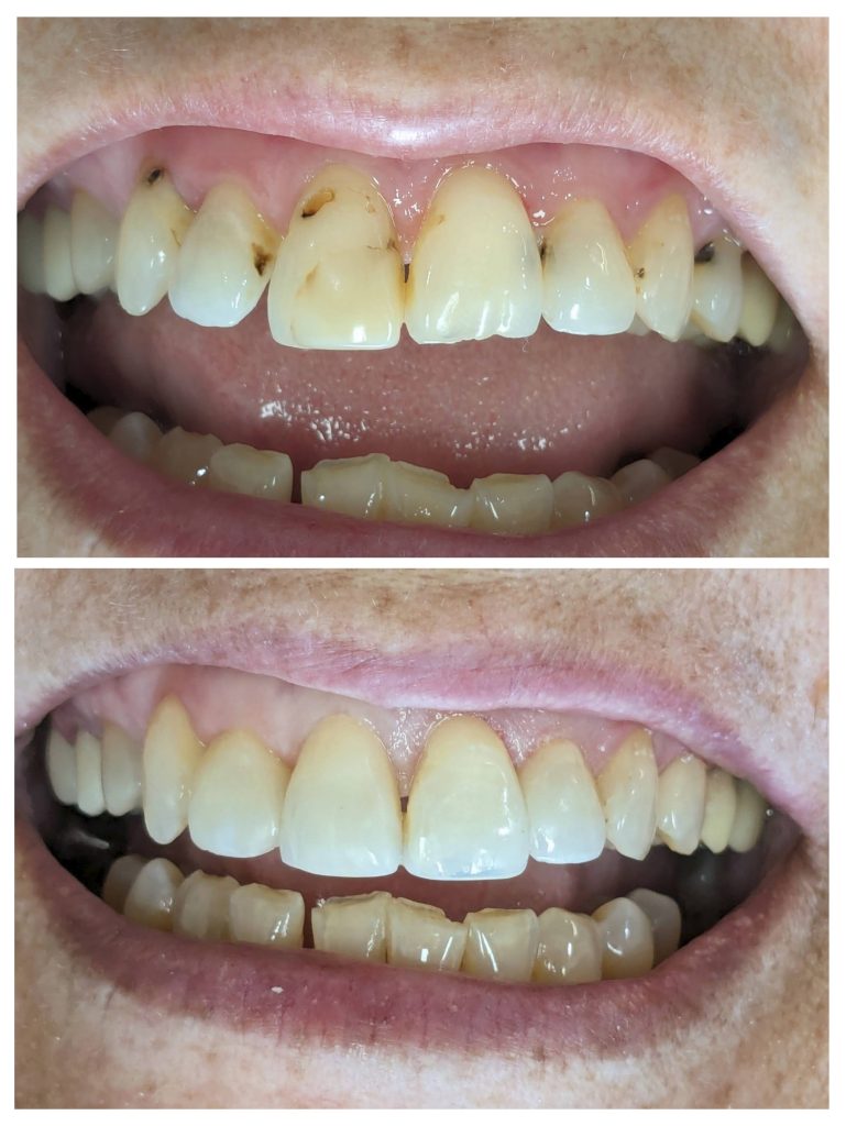 20240529_134905-COLLAGE