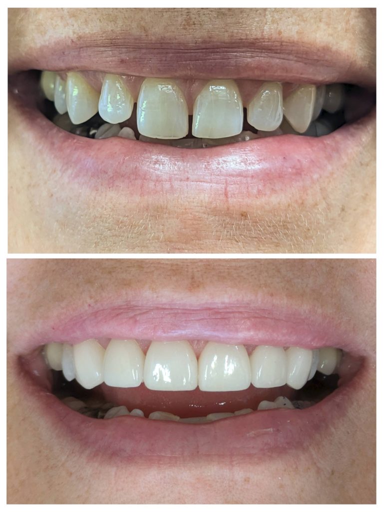 20240923_162015-COLLAGE