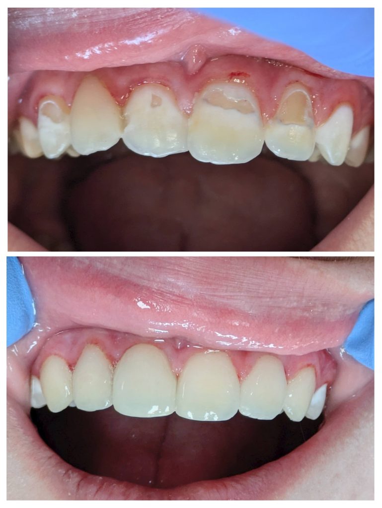 20241009_172440-COLLAGE