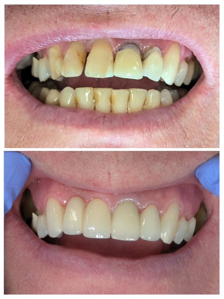 20250117_144444-COLLAGE