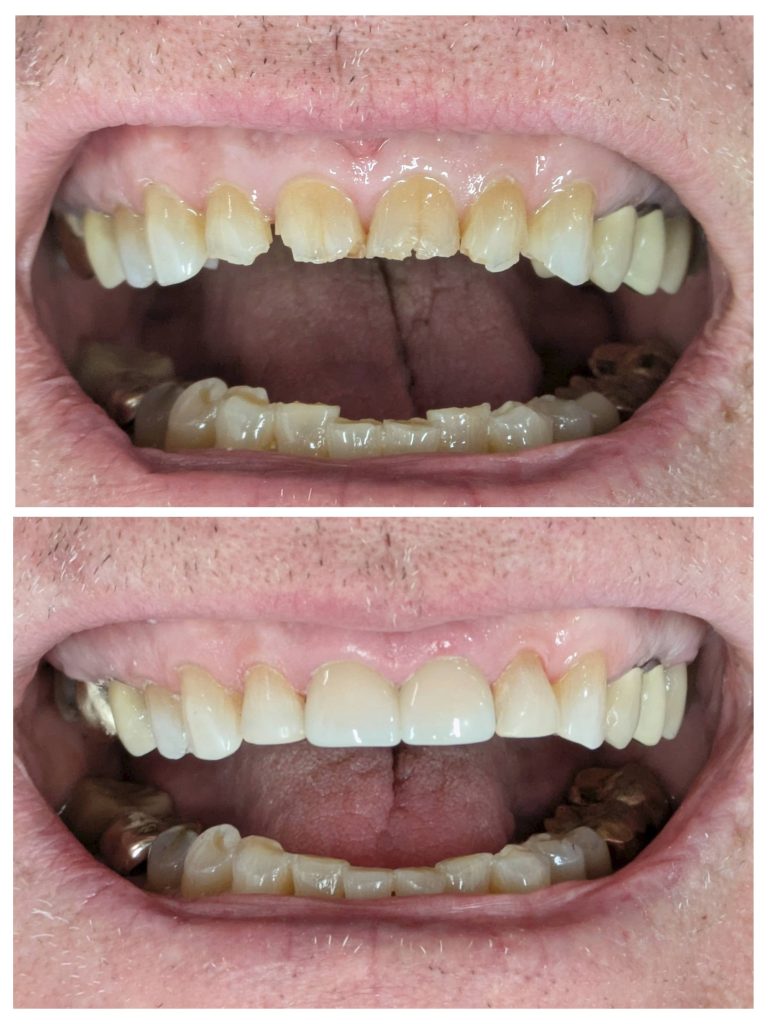 20250307_091526-COLLAGE