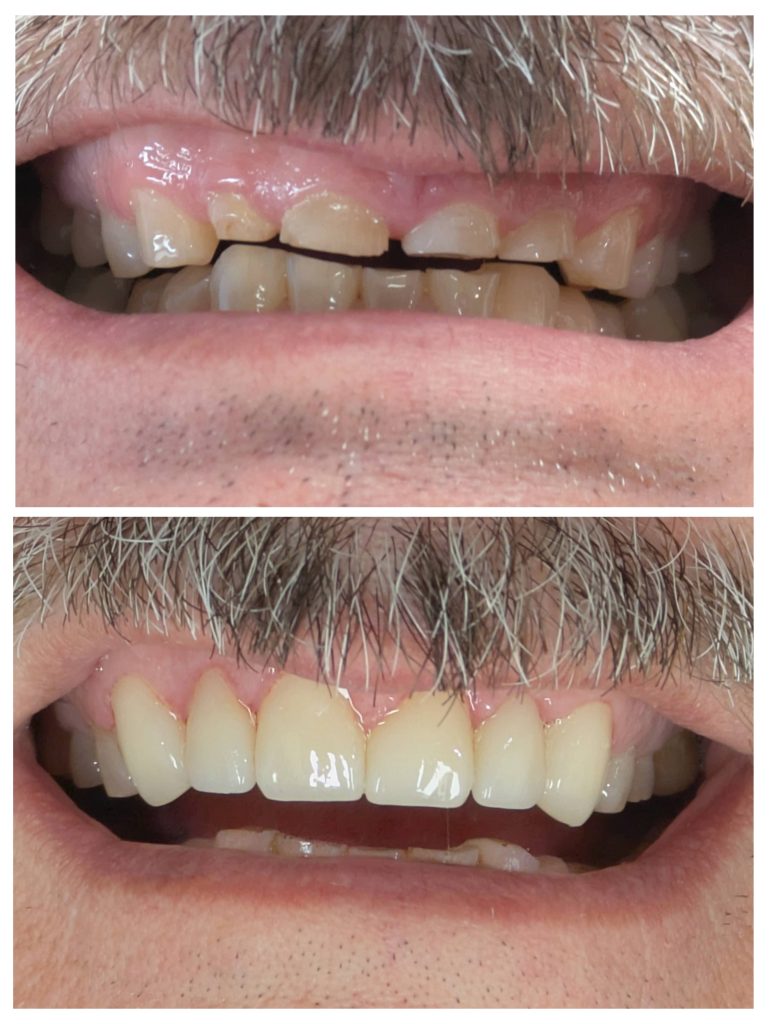 20250428_093811-COLLAGE